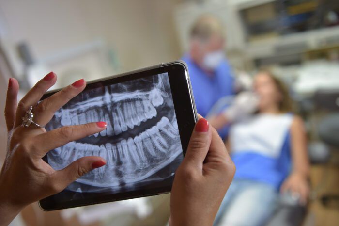 Person holding a tablet with dental x rays while a patient receives tooth extractions in The Woodlands in the background