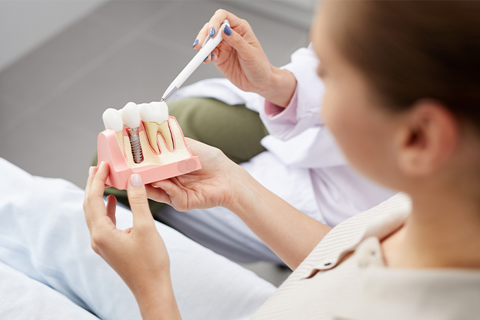 A dentist showing a patient how a dental implant works
